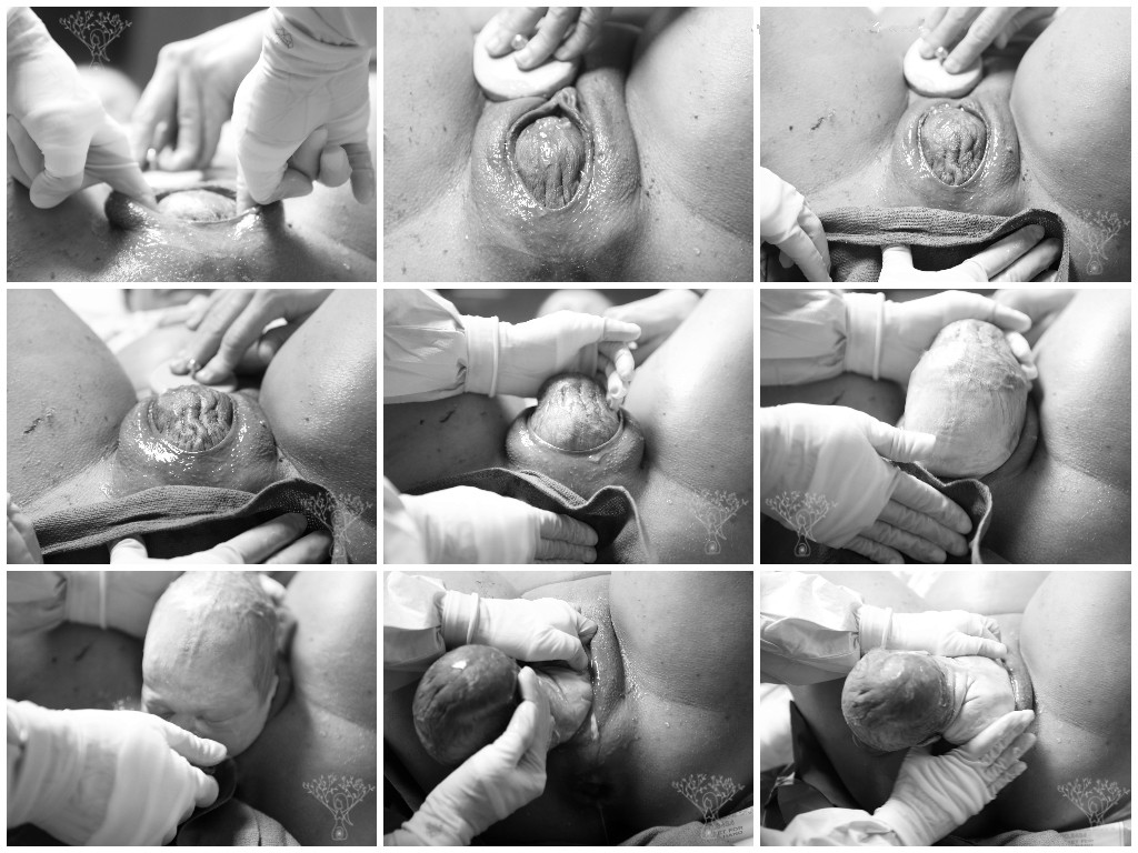 baby crowning photos