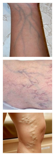 veins-showing-through-skin-causes-and-when-to-worry-new-health-advisor