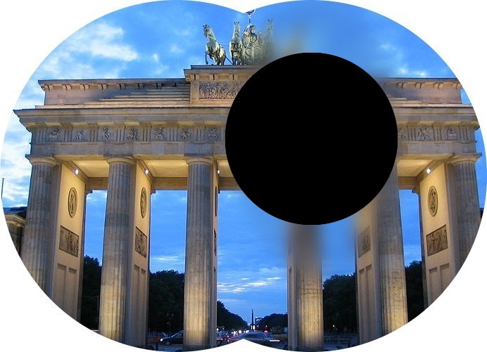 Blind Spots Revealed Understanding Your Vision - jt5rk25