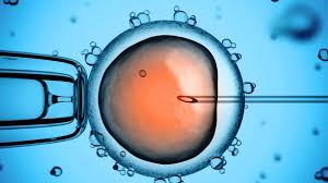 Is Cramping after Embryo Transfer Normal? | New Health Advisor