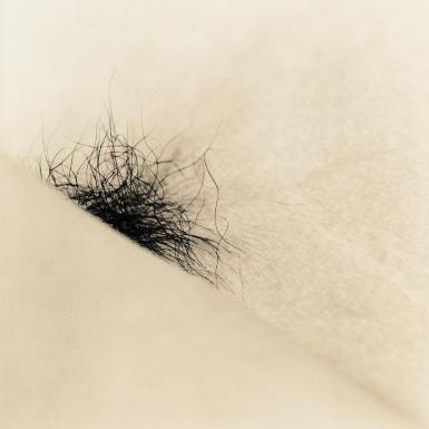 what cause pubic hair loss