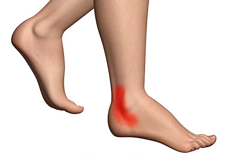 outside foot pain