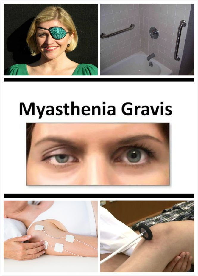 myasthenia-gravis-diagnosis-new-health-advisor