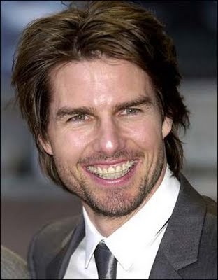 Celebrities with Braces - TSMP Medical Blog
