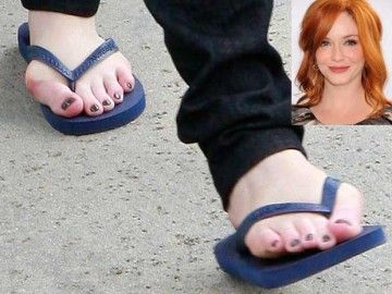 Pretty Celebrities With Bunions