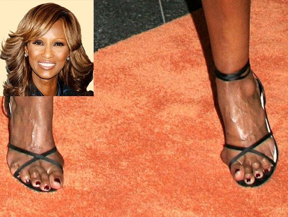 Pretty Celebrities With Bunions