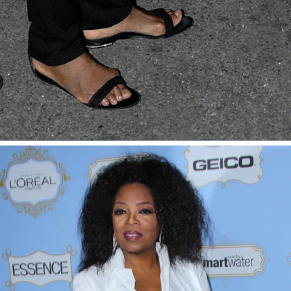 Pretty Celebrities With Bunions