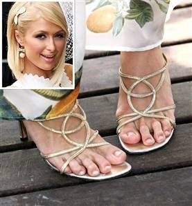 Pretty Celebrities With Bunions