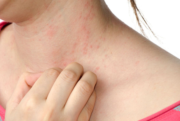 A Rash Not Itchy: Why It Happens and What to Do