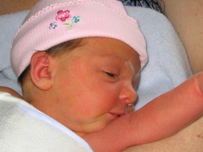 Normal Bilirubin Levels in Newborns