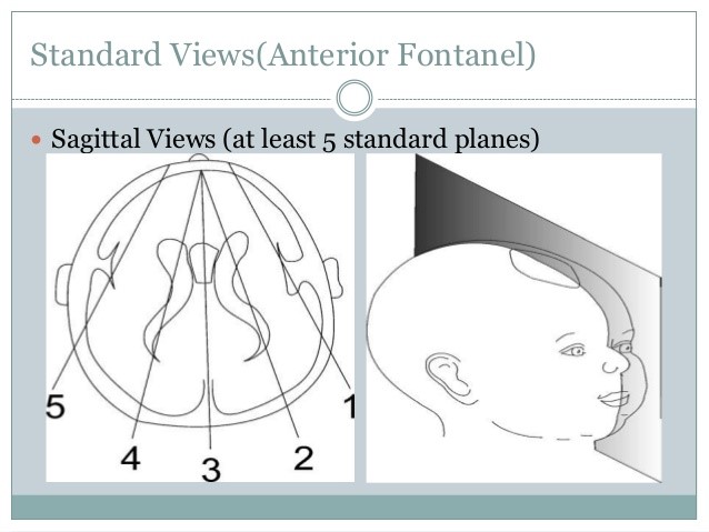 Neonatal Head Ultrasound New Health Advisor