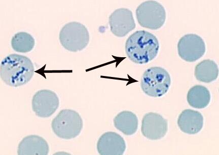 Normal Reticulocyte Count