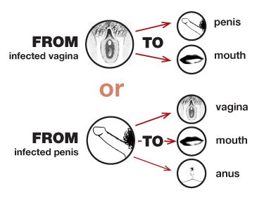 Can Pelvic Inflammatory Disease Occur in Men?