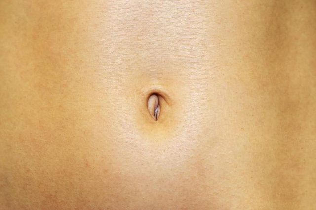 Why Does My Belly Button Smell?