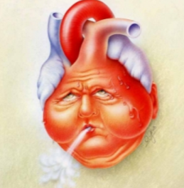 Causes of Congestive Heart Failure