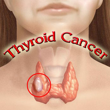 10 Common Endocrine System Disorders