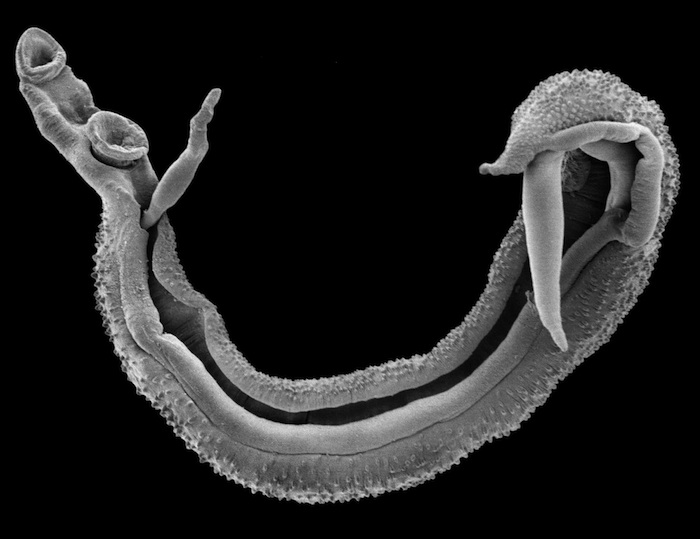 Worms in Human Types and Pictures