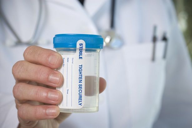 What to Do If You Get False Positive for Amphetamines