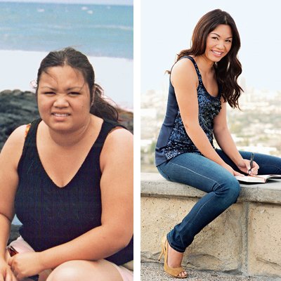 Complications of Losing Weight Too Fast