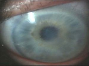 7 Reasons Why You Have Blurry Peripheral Vision