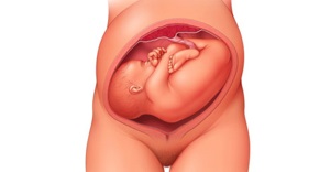 Position of Your Baby at 8 Months Pregnant
