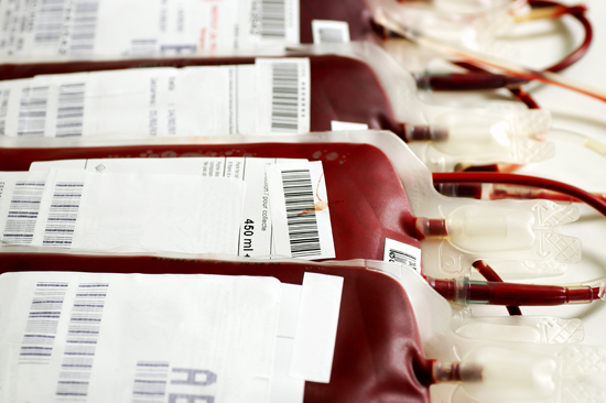 Transfusion Reactions: Adverse Effects, Causes and Treatment