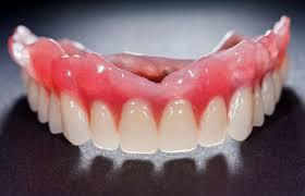 Top 6 Important Reasons to Wear Dentures